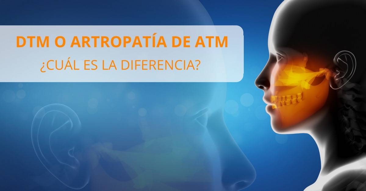 Diferencia DTM, Dolor mandibular, ATM y Artropatía Temporomandibular