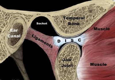 Articulación Temporomandibular - Boca abierta – Disco posicionado centralmente