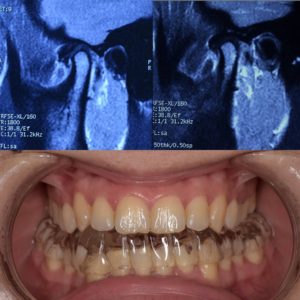 DIO Técnica Neurofisiológica