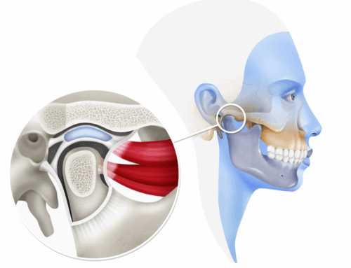 ¿Qué es ATM (Articulación Temporomandibular)?
